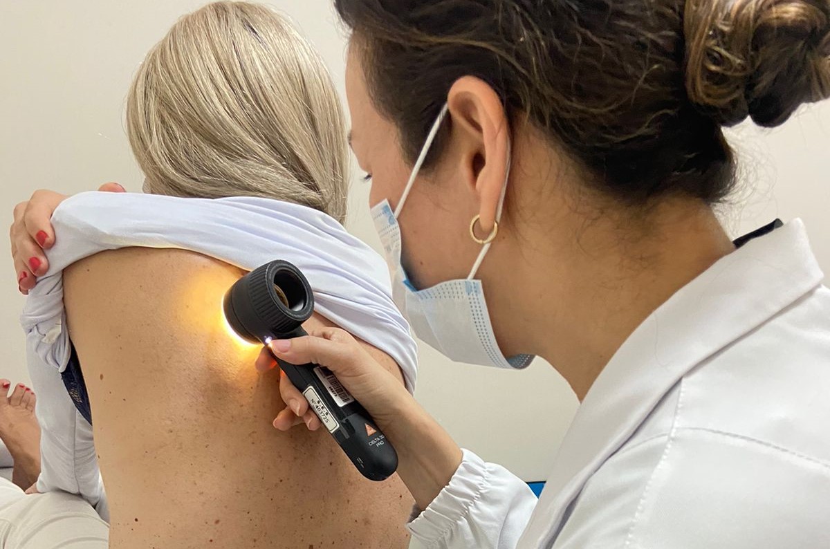 cepon_melanoma_2.jpeg