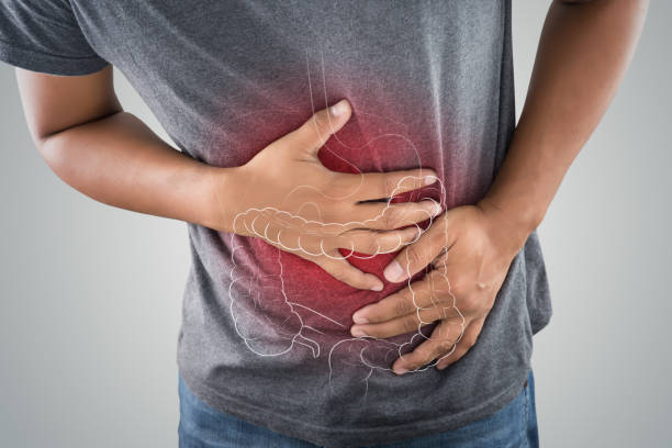 Homem vestindo camiseta cinza segurando o abdômen com as duas mãos, demonstrando dor ou desconforto. Sobre a região abdominal está sobreposto um gráfico translúcido do intestino grosso, com destaque em vermelho indicando inflamação ou dor.