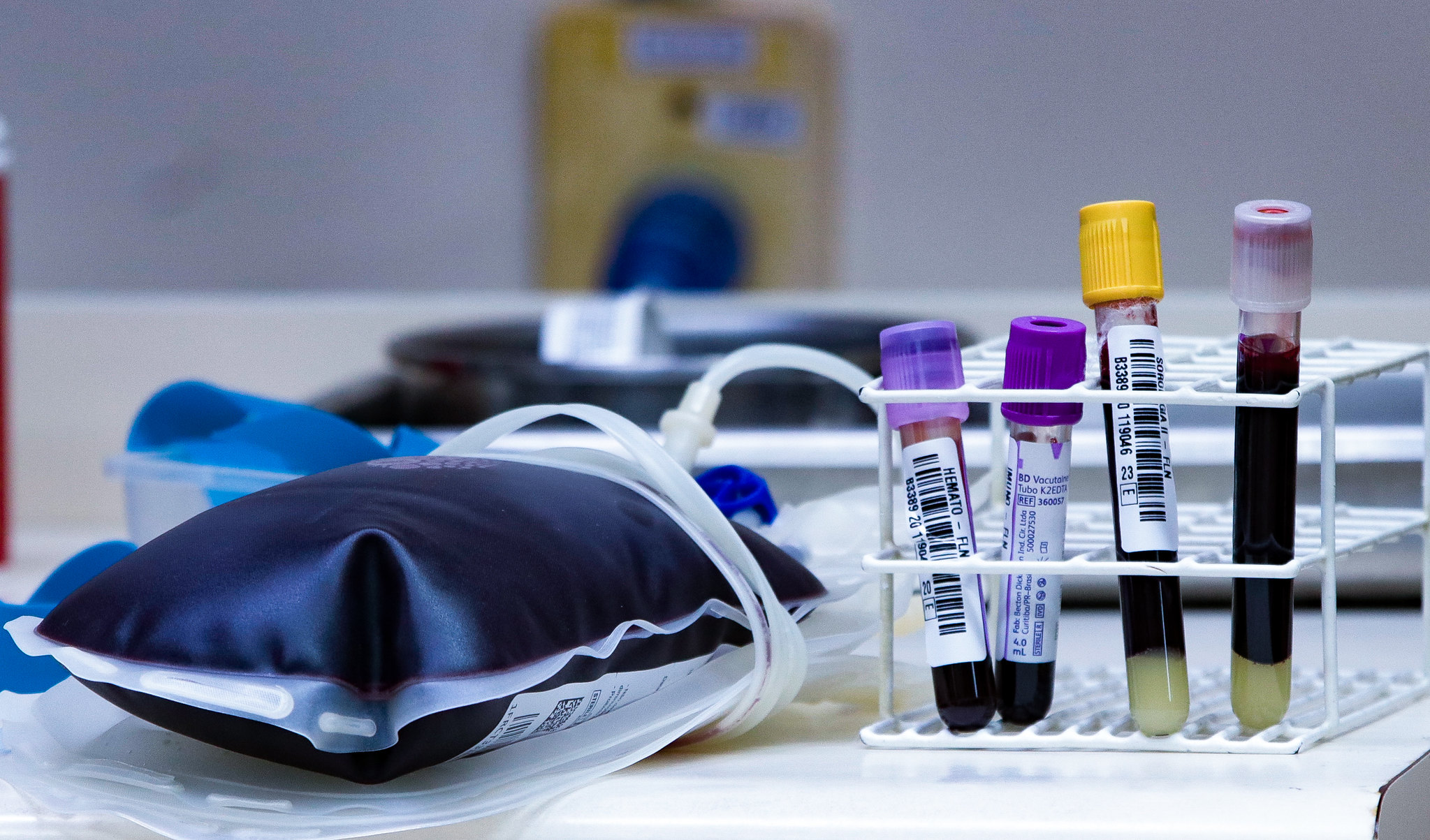 Bolsa de sangue cheia ao lado de um suporte com tubos de ensaio contendo amostras de sangue e plasma, identificados com códigos de barras. A cena retrata um ambiente laboratorial ou hospitalar, focado em coleta e análise de sangue.
