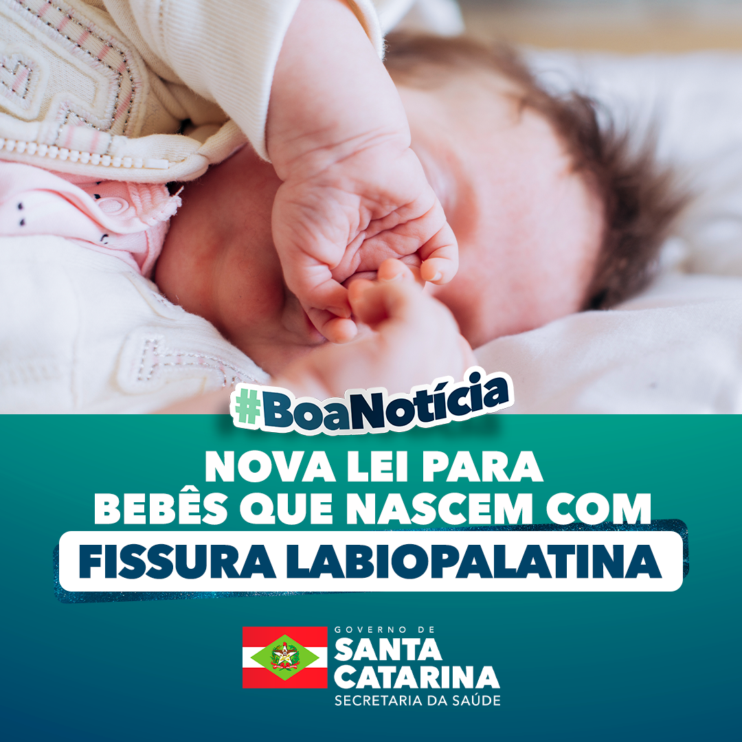 Imagem com fundo de um bebê deitado, com expressão tranquila e as mãos cobrindo parcialmente o rosto. Sobre a imagem, há um selo escrito #BoaNotícia e o texto: "Nova lei para bebês que nascem com fissura labiopalatina", em destaque com letras grandes brancas. Na parte inferior, o logotipo do Governo de Santa Catarina – Secretaria da Saúde aparece ao lado da bandeira do estado.