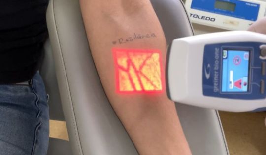 Braço de uma pessoa apoiado em uma cadeira de coleta, com um aparelho de realidade aumentada projetando em vermelho as veias sob a pele. Acima da área projetada está escrita a palavra ‘Resiliência’ como se fosse uma tatuagem ou anotação. O equipamento usado é um localizador de veias da marca Greiner Bio-One. Ao fundo, uma balança da marca Toledo.