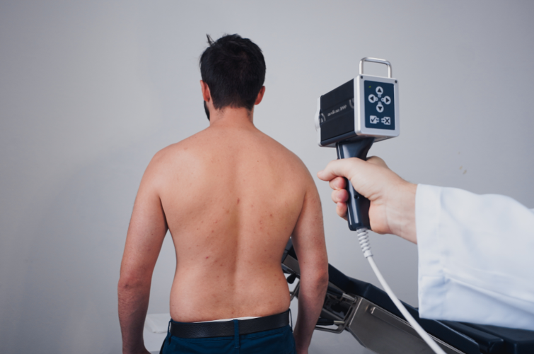 A imagem mostra um homem de costas, sem camisa, enquanto uma pessoa à direita, vestindo um jaleco branco, segura um dispositivo portátil direcionado para suas costas. O aparelho parece ser um equipamento médico de diagnóstico por imagem ou detecção, possivelmente para exames de pele, avaliação de postura ou escaneamento corporal. Ao fundo, há uma maca parcialmente visível, sugerindo que a cena ocorre em um ambiente clínico ou de consultório médico.