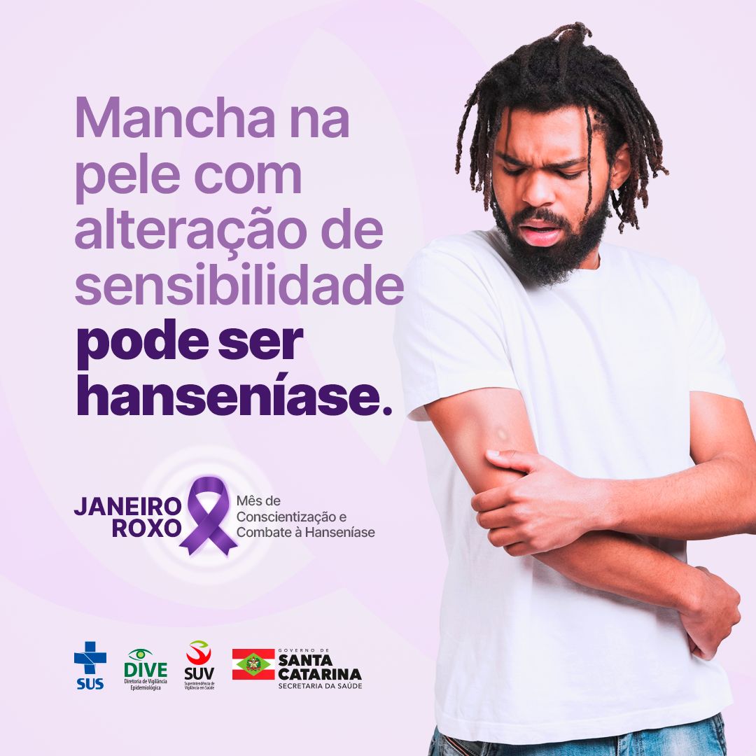 hanseniase