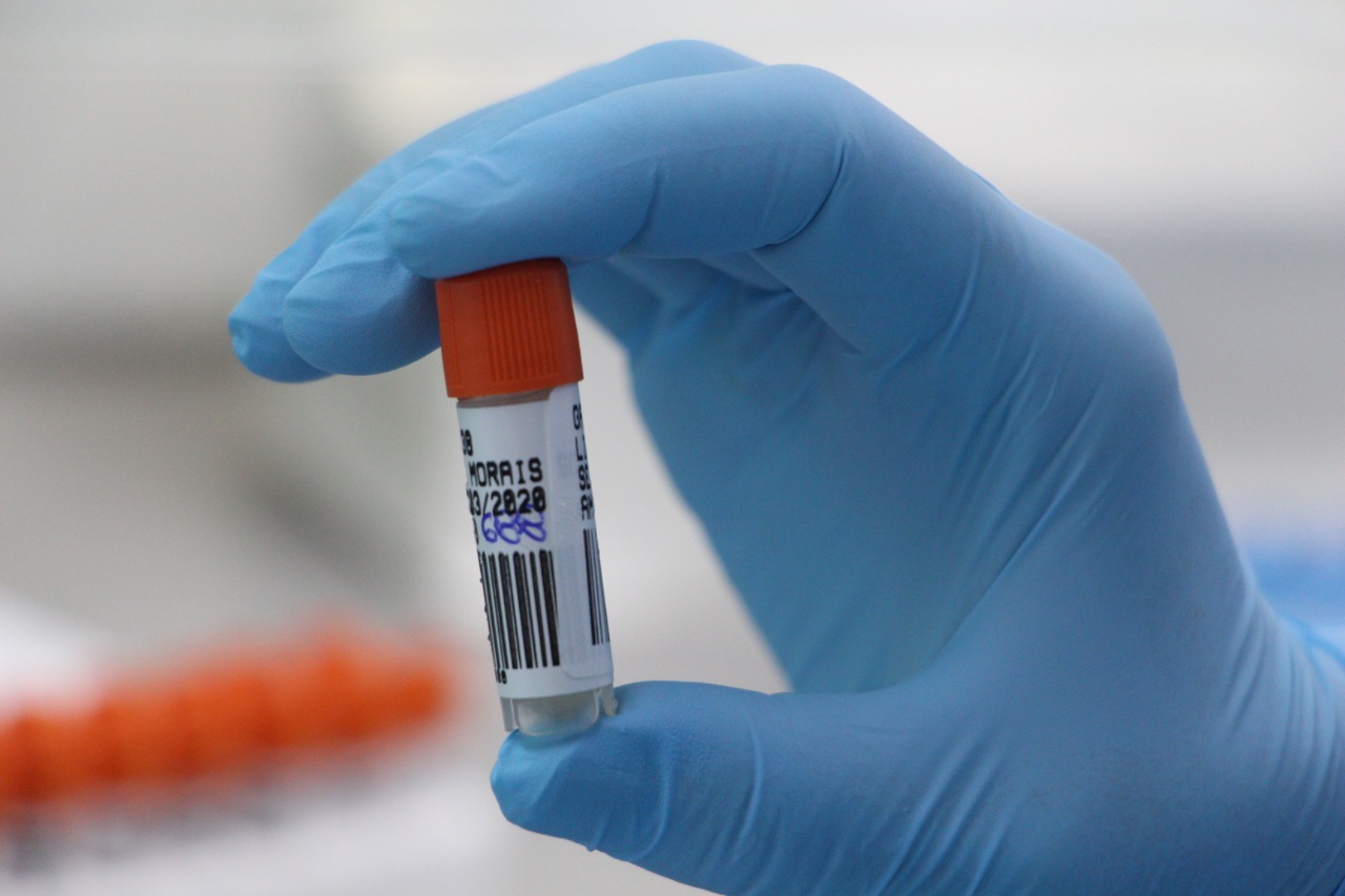 Mão com luva azul segura um tubo de ensaio com tampa laranja, utilizado para coleta de amostras em testes laboratoriais. 
