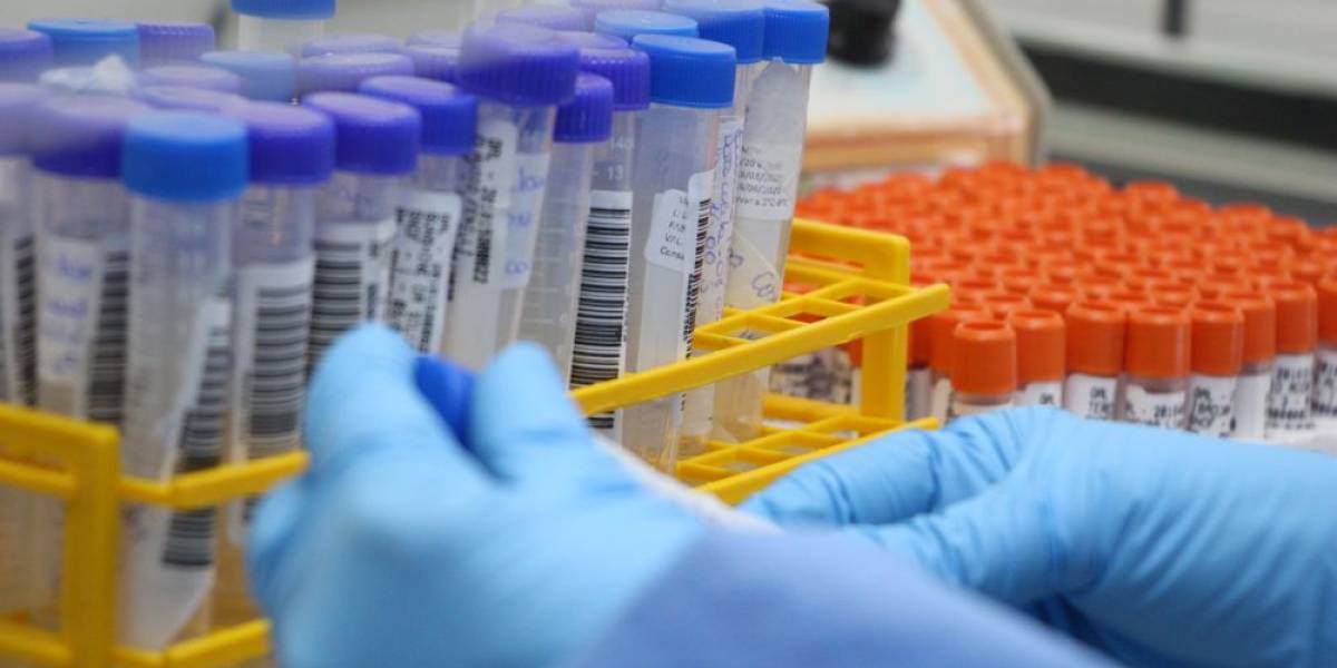 LACEN SC: 74 anos de pioneirismo na vigilância em saúde