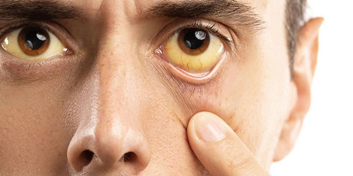 Julho Amarelo: Saúde alerta para a conscientização e combate às hepatites virais