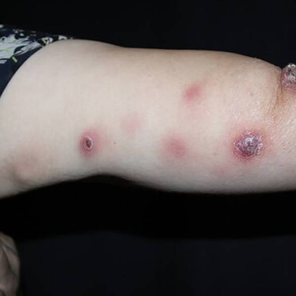 Governo do Estado promove capacitação para o enfrentamento da esporotricose em Santa Catarina