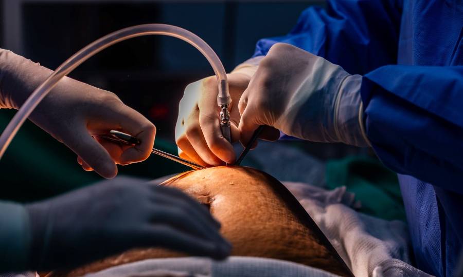 Governo do Estado aprova ampliação do acesso a cirurgias bariátricas no Hospital Bethesda, em Joinville