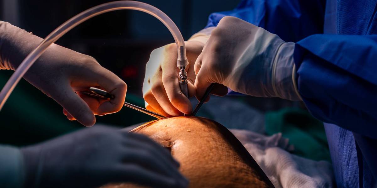 Governo do Estado aprova ampliação do acesso a cirurgias bariátricas no Hospital Bethesda, em Joinville