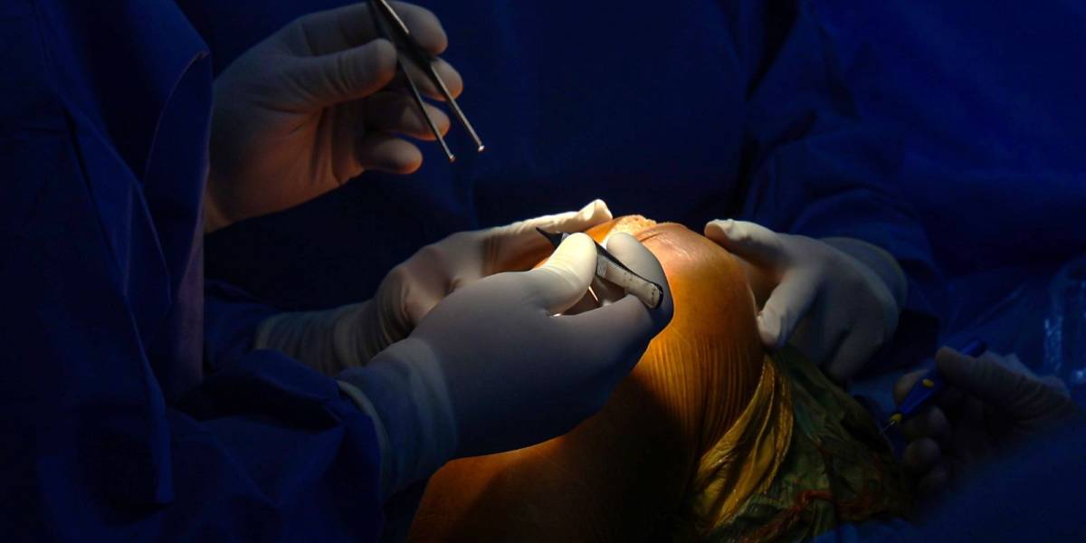 Governo do Estado aprova habilitação em ortopedia para o Hospital São José de Maravilha