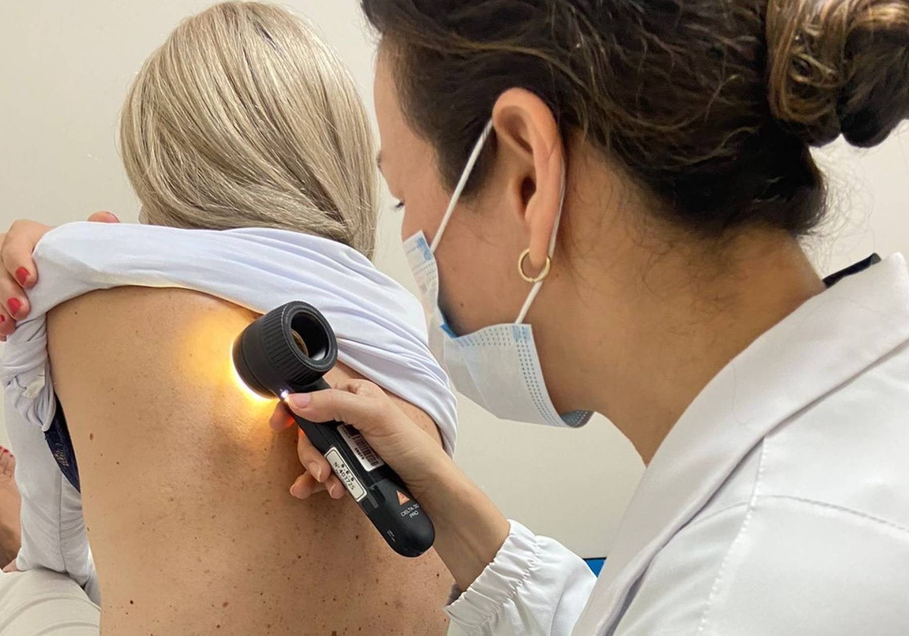 Estado reforça a importância da prevenção e do diagnóstico precoce do melanoma